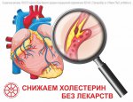 15 - 21 января - Неделя профилактики неинфекционных заболеваний. Снижаем холестерин без лекарств